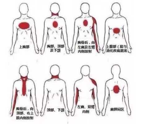 心脏不好后背哪里疼（心脏不好后背哪里疼图片）-图1
