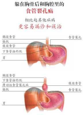 阜阳哪里看胃病好（阜阳哪里看胃病好点）-图2