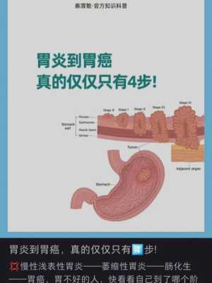 义乌看胃病哪里好（义乌看胃病哪里好一点）-图1