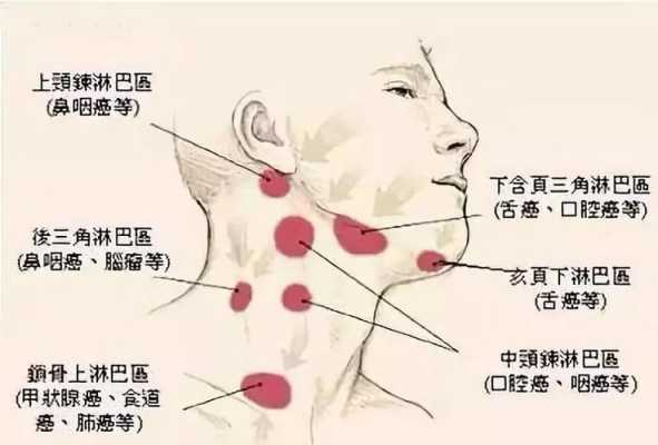 淋巴主要分布在哪里（淋巴长在人身体的哪些部位）-图2