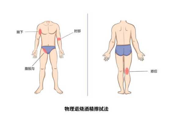 酒精退烧的哪里个部位（酒精退烧的哪里个部位）-图2