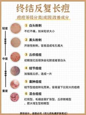 去痘印哪里有效果（去痘印哪里有效果呢）-图1